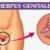 Herpes genitale: cosa succede in caso di contagio