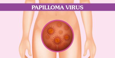 sintomi papilloma virus