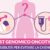 Oncotype, il test genomico per evitare la chemio