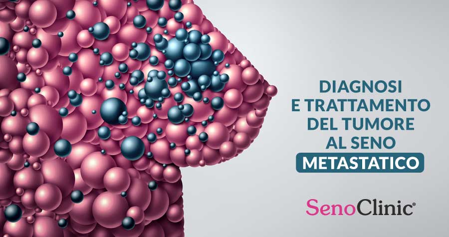 Il-tumore-al-seno-metastatico-Roma-senoclinic