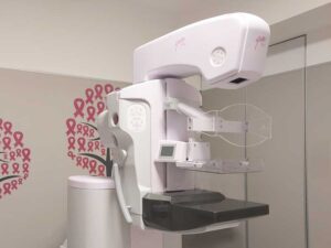 mammografo-giotto-senoclinic-roma