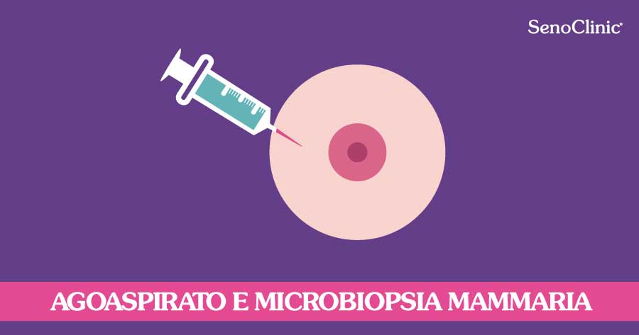 ago-aspirato-seno-microbiopsia-mammaria-roma-senoclinic