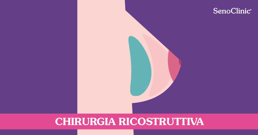 chirurgia-plastica-ricostruttiva-seno-roma-senoclinic
