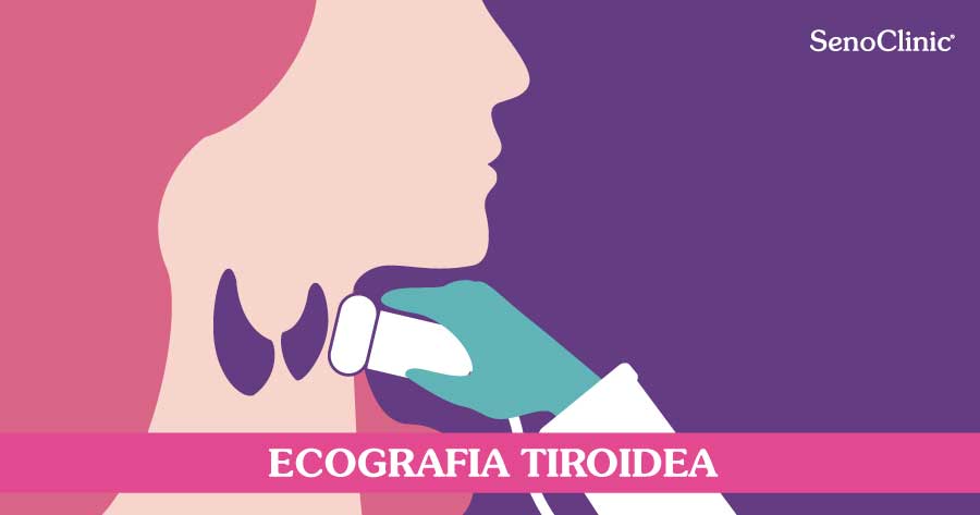 ecografia-tiroidea-a-roma-senoclinic