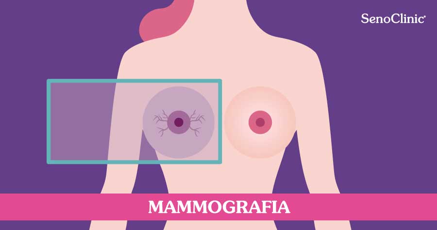 mammografia-roma-senoclinic