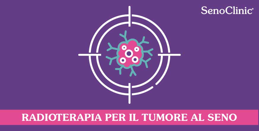 la-radioterapia-per-il-tumore-al-seno-roma-senoclinic