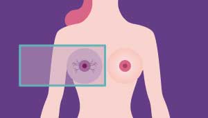 Senologia a Roma mammografia senoclinic