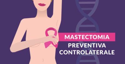 Mastectomia preventiva controlaterale