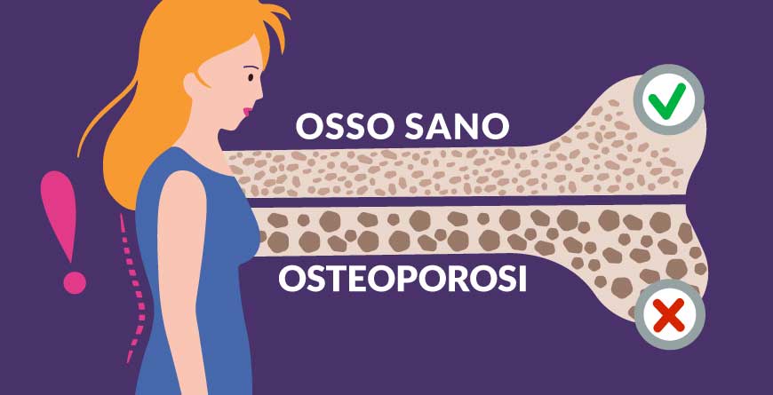 osteoporosi-la-ladra-che-ruba-le-ossa-in-silenzio-roma-senoclinic