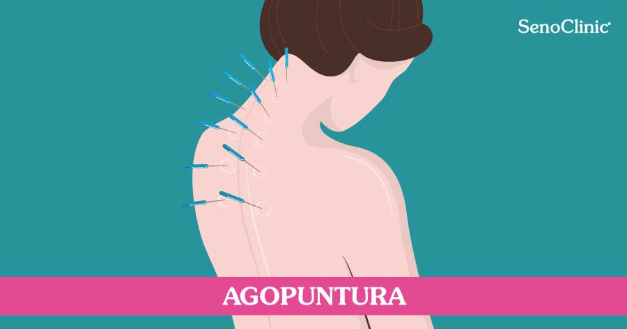 agopuntura-roma-senoclinic