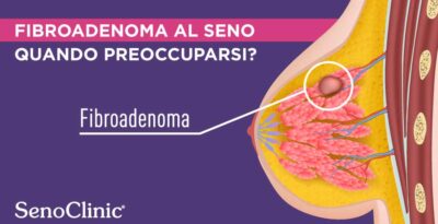 Fibroadenoma al seno
