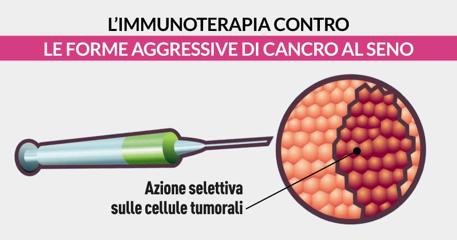 immunoterapia-contro-le-forme-aggressive-di-tumore-al-seno-senoclinic