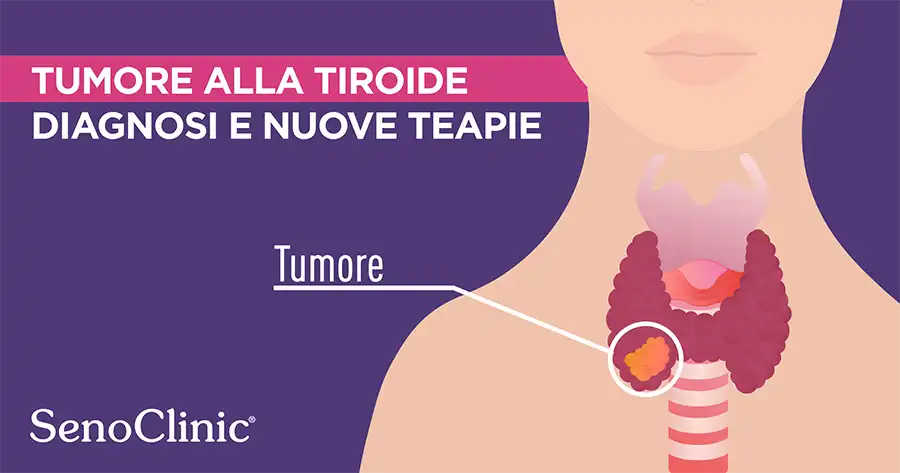 tumore alla tiroide senoclinic roma